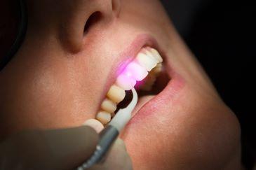 laser dentistry rutland